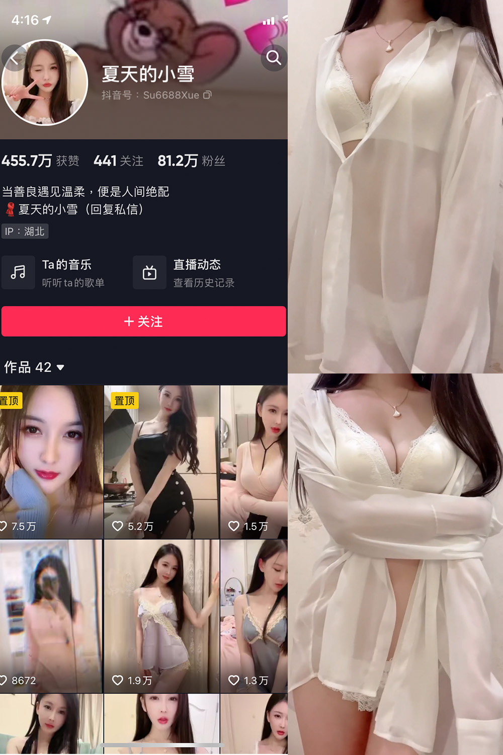 抖音 夏天的小雪 微密圈 嘉宾专享 NO.001-011期 更新至：2023.8.11