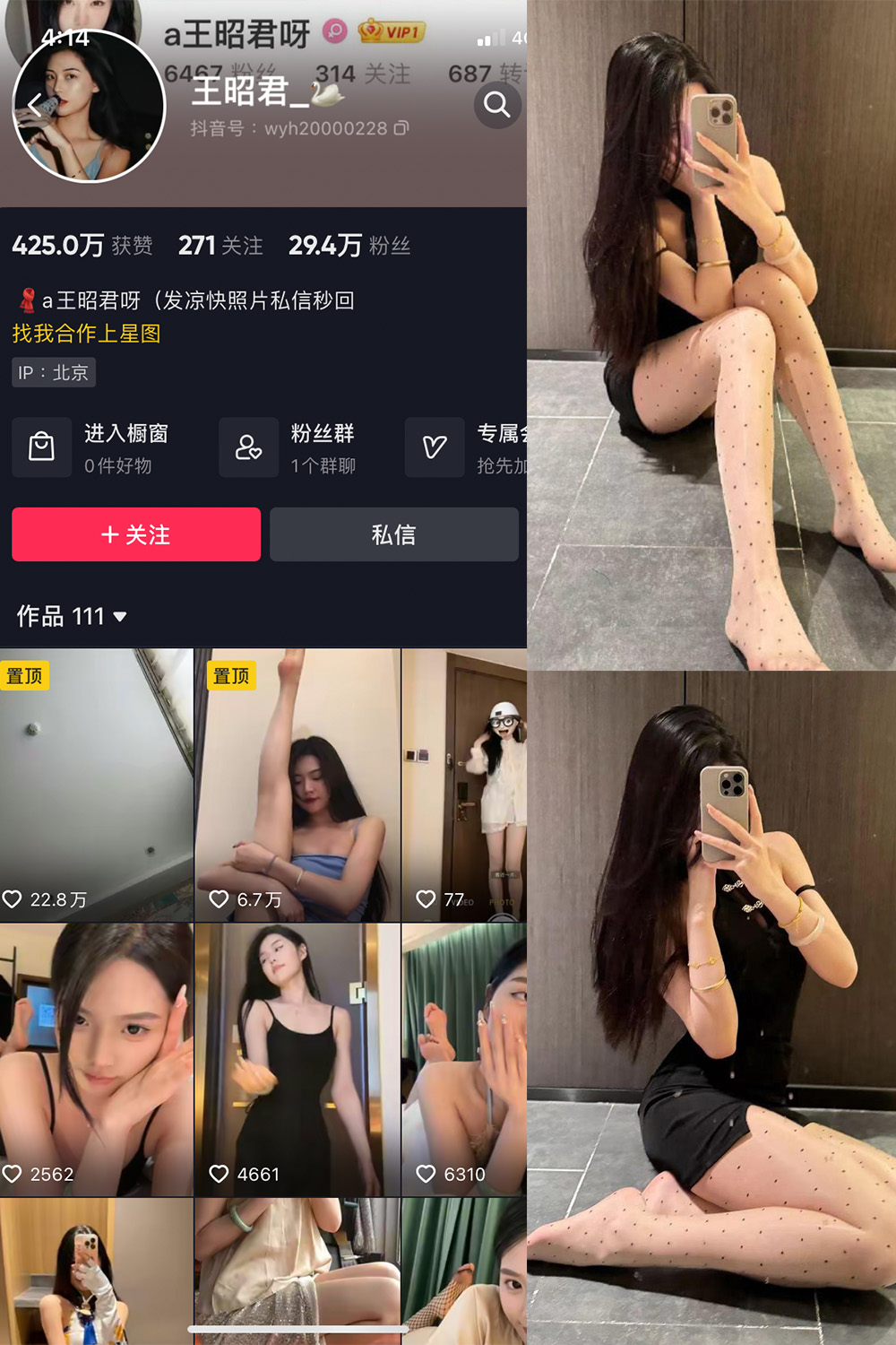 抖音 王昭君 微密圈 NO.022期 更新至：2024.3.13