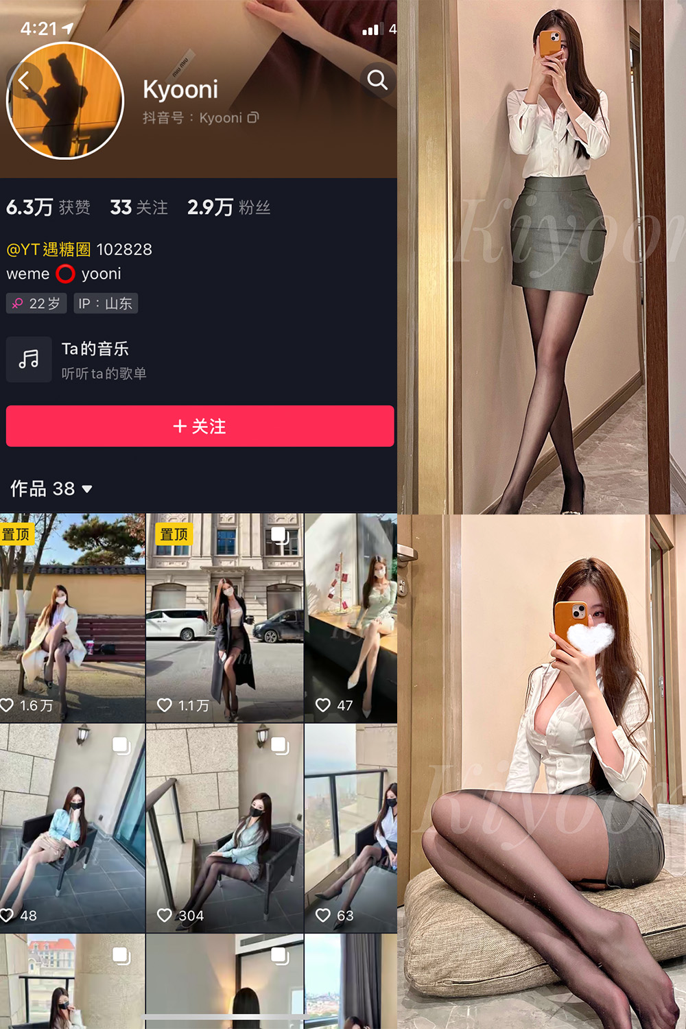 抖音 Yooni有你喵 微密圈 NO.002期