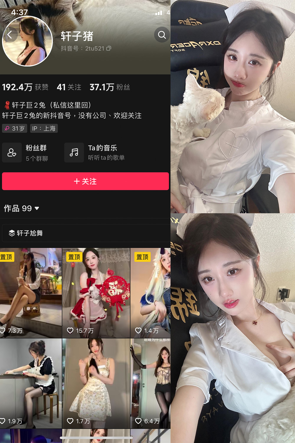 抖音 轩子巨二兔 微密圈 NO.023期 更新至：2024.3.15