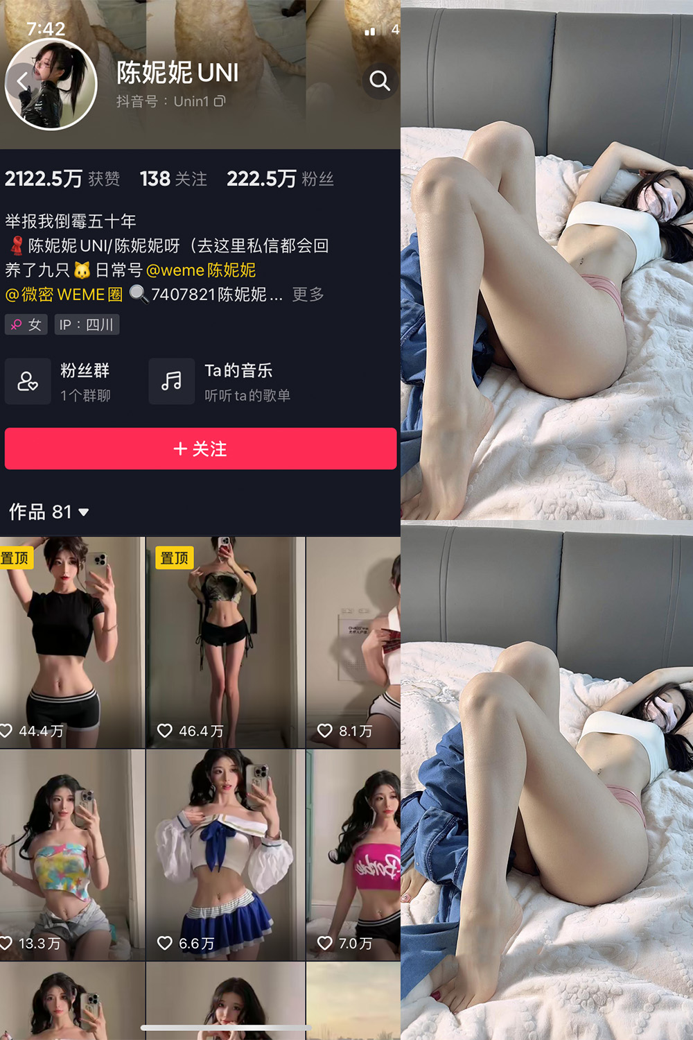 抖音 陈妮腻UNI 微密圈 NO.005期