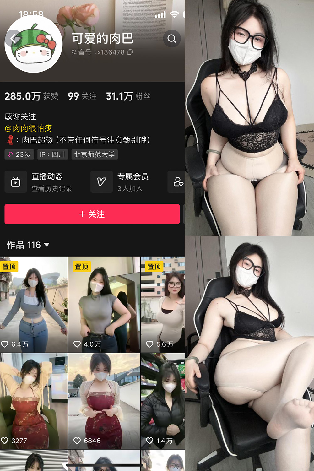 抖音 可爱的肉巴 微密圈 NO.022期 更新至：2024.4.25