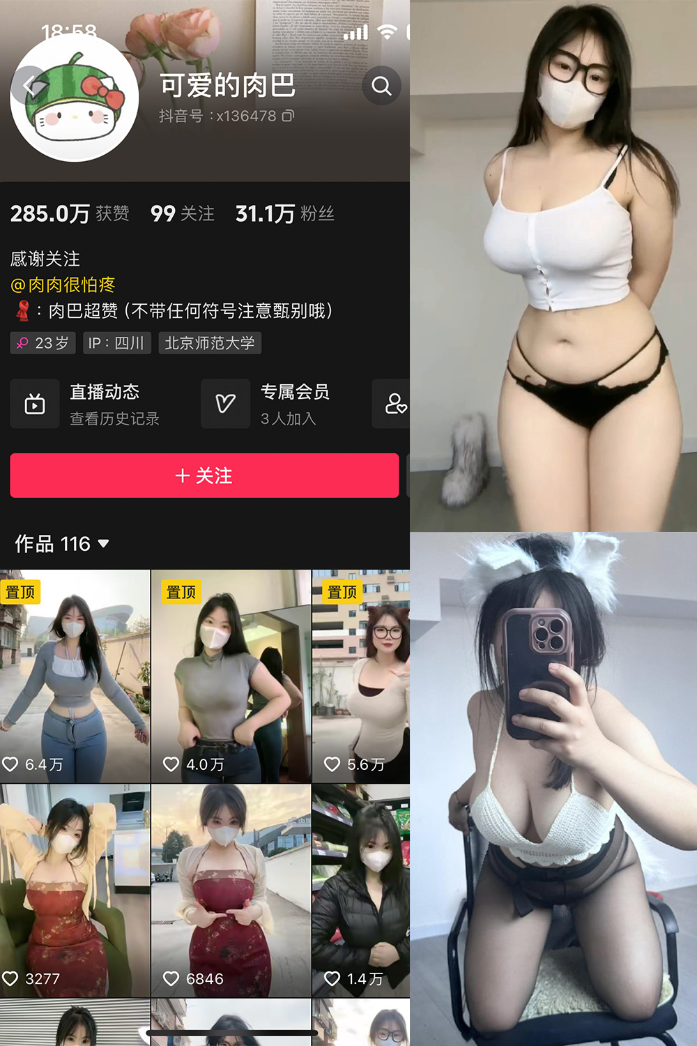 抖音 可爱的肉巴 微密圈 NO.014期 更新至：2024.3.7