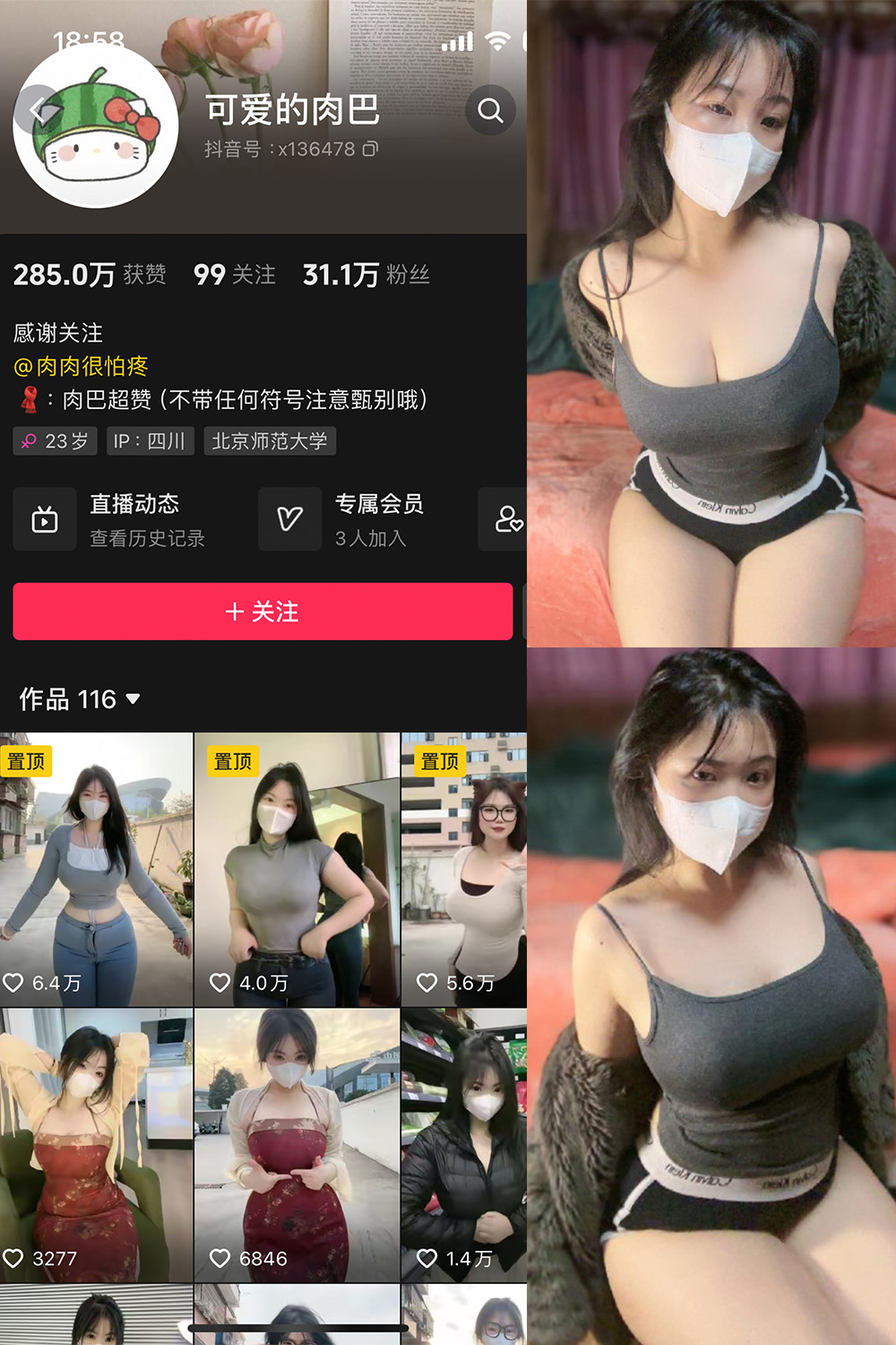 抖音 可爱的肉巴 微密圈 NO.011期 更新至：2024.2.19