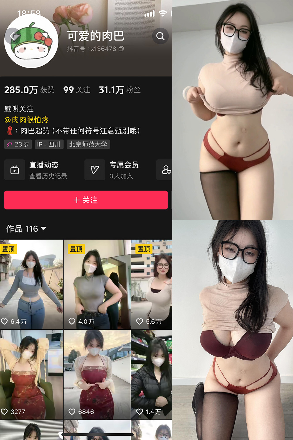 抖音 可爱的肉巴 微密圈 NO.009期 更新至：2024.11.7